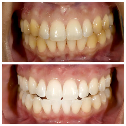 WhiteWave Toothpaste