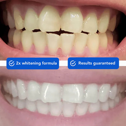 Teeth Whitening Powder